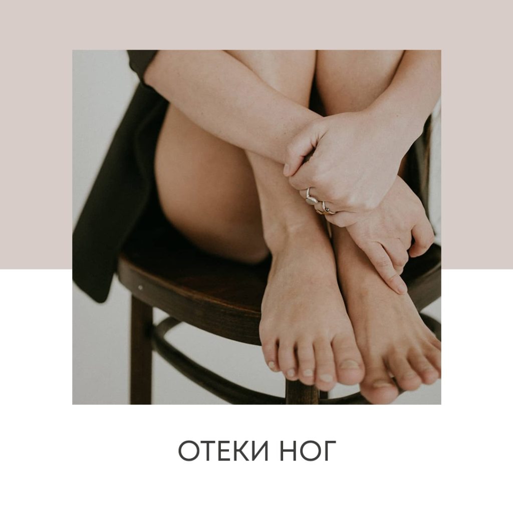 Отеки ног у женщин